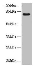 Polyclonal Rabbit anti-Human TTC30A Antibody (IHC, WB)