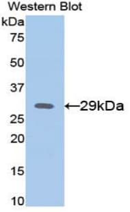 Alpha-Fetoprotein Antibody (aa399-605, Biotin)