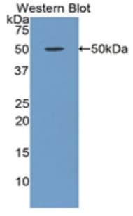 ORM1 / Orosomucoid Antibody (aa33-195, Biotin)