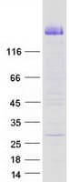 Human CDHR2 Protein (Recombinant Myc-DDK (Flag))