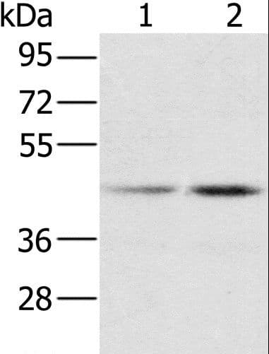 RBMX Antibody