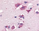 Polyclonal Rabbit anti-Human TNFSF10 / TRAIL Antibody (IHC, WB)