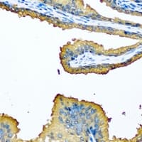 Polyclonal Rabbit anti-Human MCCC2 / MCCB Antibody (IHC, WB)