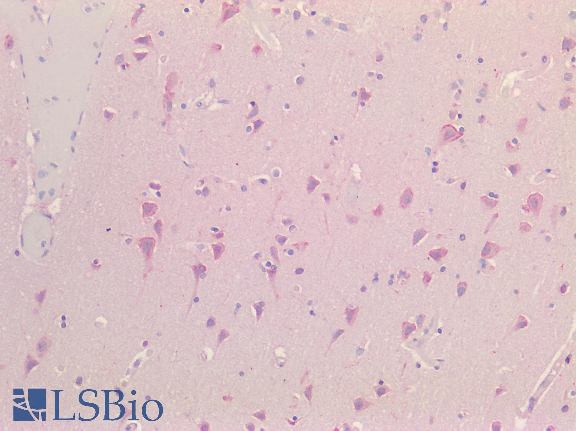 IHC-plus™ Polyclonal Rabbit anti-Human NALP3 / NLRP3 Antibody (Internal Region, IHC)