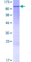Human YME1L1 Protein (Recombinant GST)