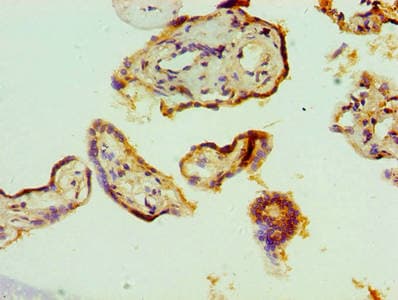 TDP-43 / TARDBP Antibody (aa1-260)