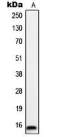 IHC-plus™ Polyclonal Rabbit anti-Human ORAOV1 Antibody (Internal, IHC, IF, WB)