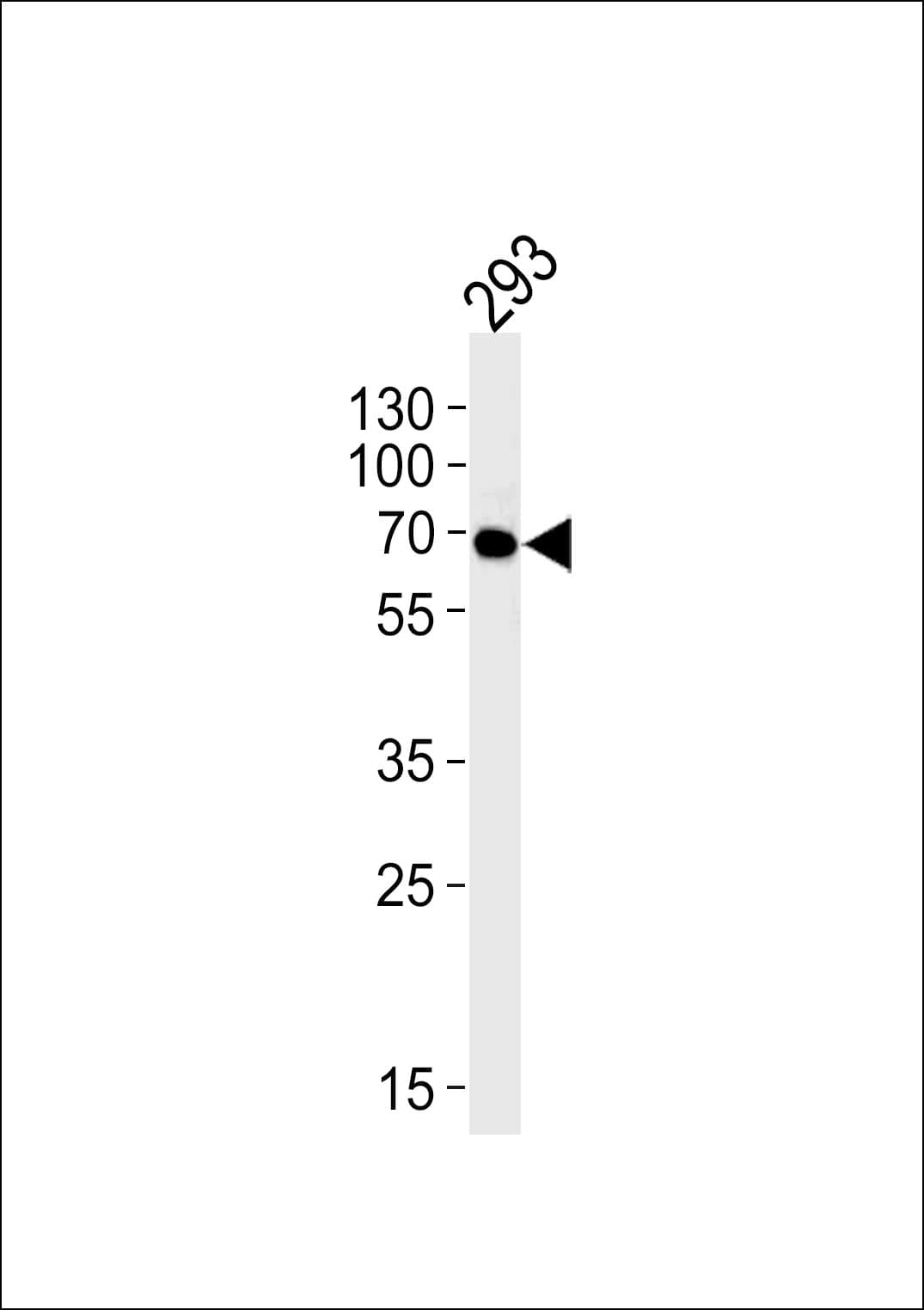 SYN / FYN Antibody (clone 1302CT390.118.237)