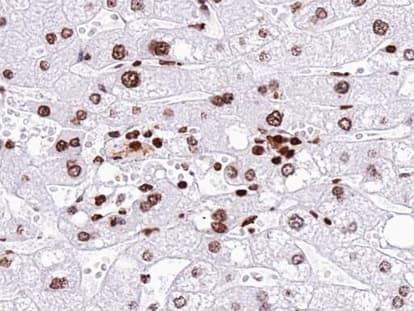 Polyclonal Rabbit anti-Human NEUROG1 / NGN1 / Neurogenin 1 Antibody (IHC, WB)