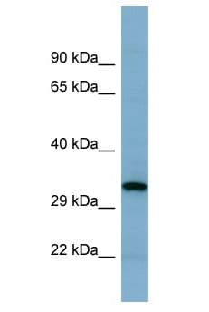 GINS4 / SLD5 Antibody (aa2-51)