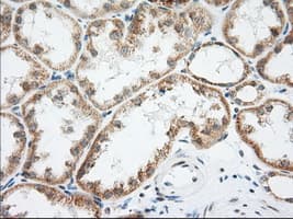 LOX / Lysyl Oxidase Antibody (aa22-168, clone OTI4E3, Carrier-free)