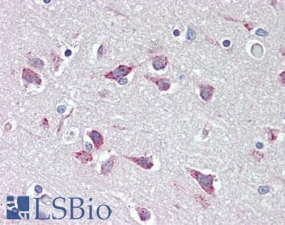 IHC-plus™ Polyclonal Rabbit anti-Human B3GALTL Antibody (aa449-498, IHC, WB)