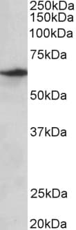 IHC-plus™ SLC47A2 Antibody (aa546-560)