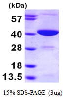 Human GMPR2 Protein (Recombinant His)