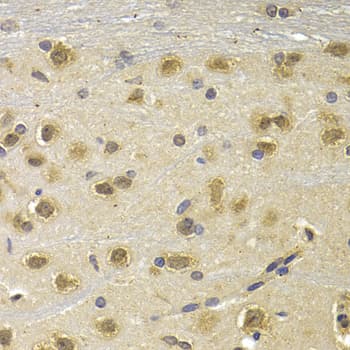 NUDT6 Antibody