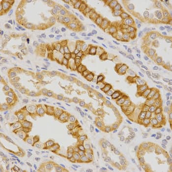IL23R Antibody