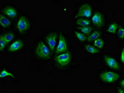 Polyclonal Rabbit anti-Human F2RL1 / PAR2 Antibody (IHC, IF)