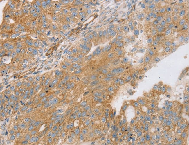 STX16 / Syntaxin 16 Antibody