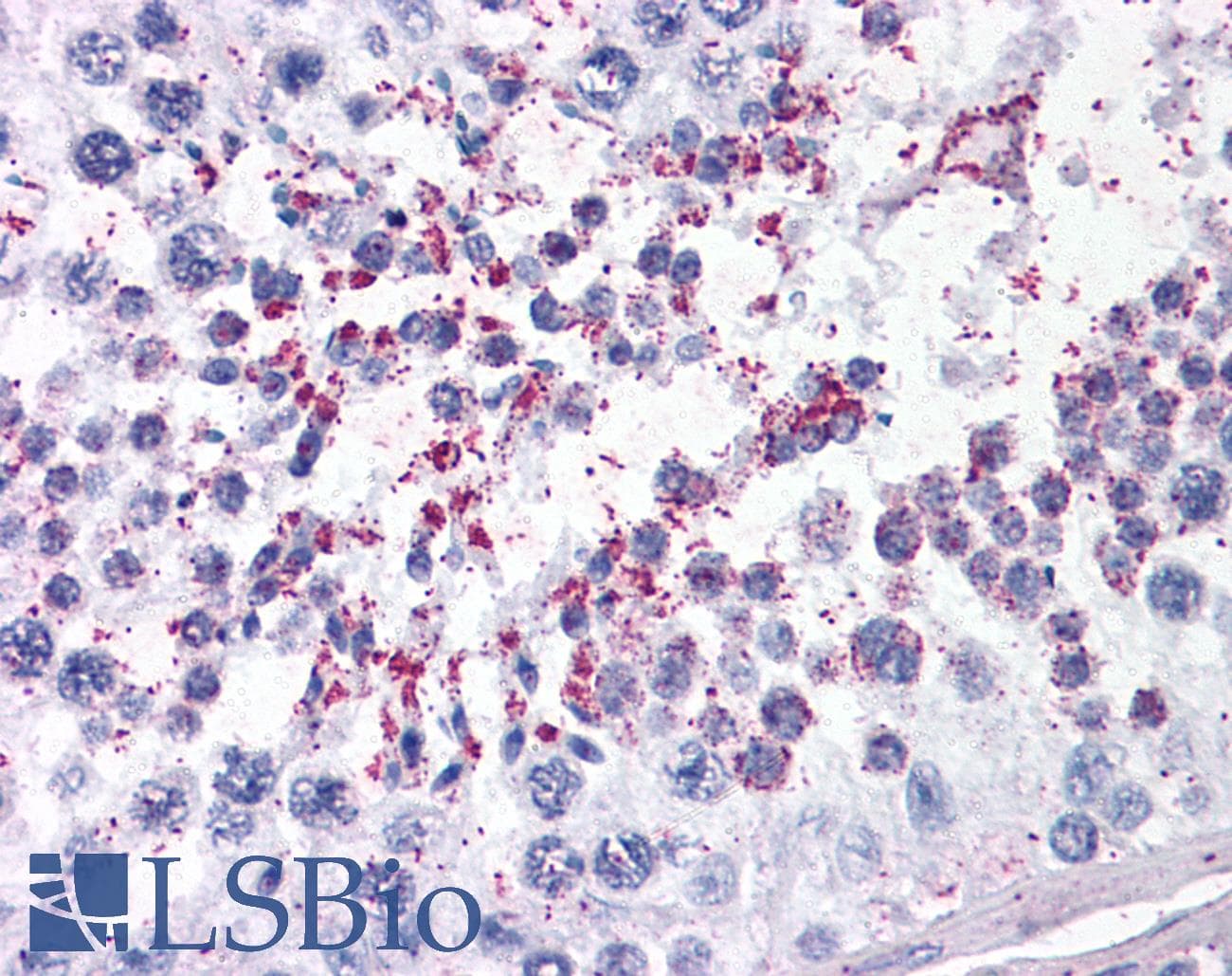 IHC-plus™ Polyclonal Goat anti-Human DUSP14 Antibody (aa186-198, IHC)