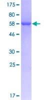 Human GIPC2 Protein (Recombinant GST)