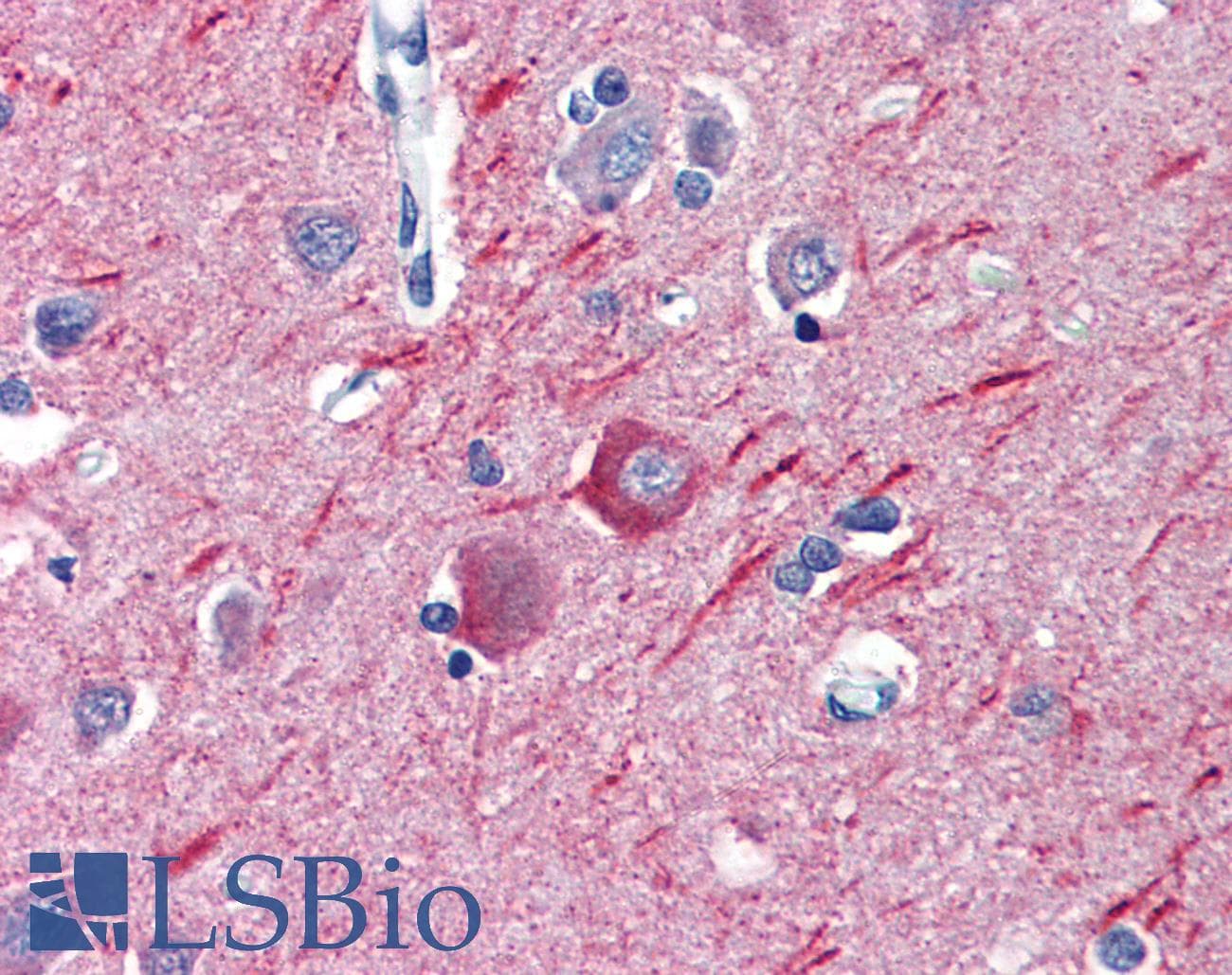 IHC-plus™ Monoclonal Rat anti-Yeast Alpha Tubulin Antibody (clone YOL1/34, IHC, IF, WB)