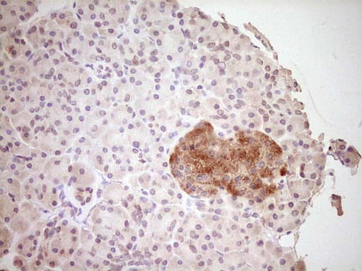 CLOCK Antibody (aa1-285, clone OTI1G3)