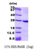Human PRNP / PrP / Prion Protein (Recombinant His)