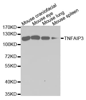 TNFAIP3 / A20 Antibody
