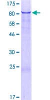 Human RIC3 Protein (Recombinant GST)