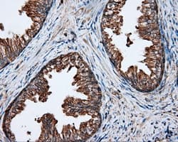 PIM2 / Pim-2 Antibody (clone OTI5D5)