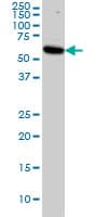 AKT1 Antibody (clone 2E11)