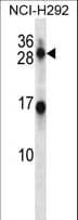 Polyclonal Rabbit anti-Human KLK14 / Kallikrein 14 Antibody (aa15-44, WB)