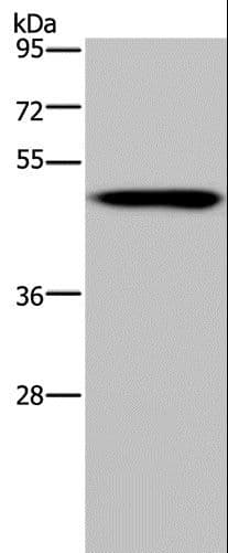 NDUFS2 Antibody