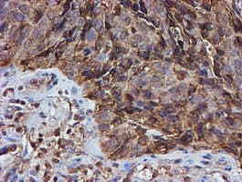 PSMB9 Antibody (clone OTI3F3)