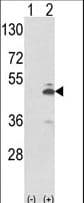 PKM / Pyruvate Kinase, Muscle Antibody (aa116-145)