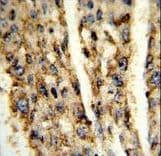 Polyclonal Rabbit anti-Human DIO3 Antibody (aa250-278, IHC, WB)