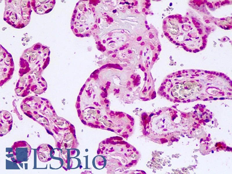 IHC-plus™ TCF7L2 / TCG4 Antibody (N-Terminus)