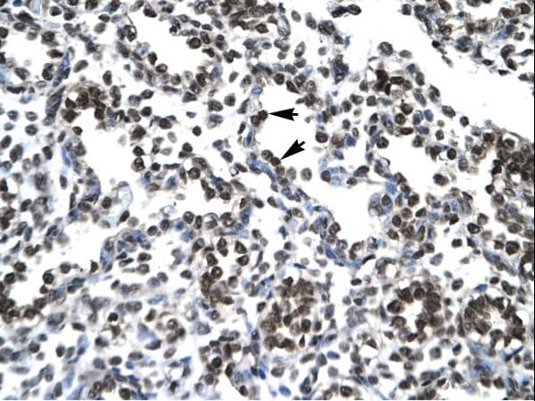 PTHLH / PTHRP Antibody (C-Terminus)