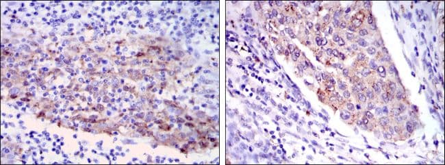 Monoclonal Mouse anti-Human MMP1 Antibody (clone 6A5, IHC, IF, WB)