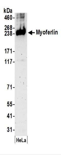IHC-plus™ Polyclonal Rabbit anti-Human MYOF / Myoferlin Antibody (aa700-750, IHC, WB)