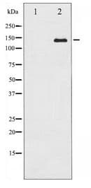 Polyclonal Rabbit anti-Human CASR/Calcium Sensing Receptor Antibody (IHC, WB)