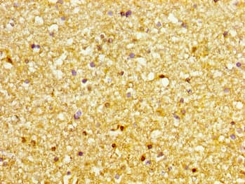 Polyclonal Rabbit anti-Human DVL3 / Dishevelled 3 Antibody (IHC)