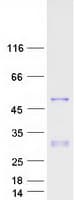 Human PAX2 Protein (Recombinant Myc-DDK (Flag))