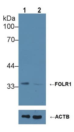 Polyclonal Rabbit anti-Human FOLR1 / Folate Receptor Alpha Antibody (aa25-234, IHC, WB)