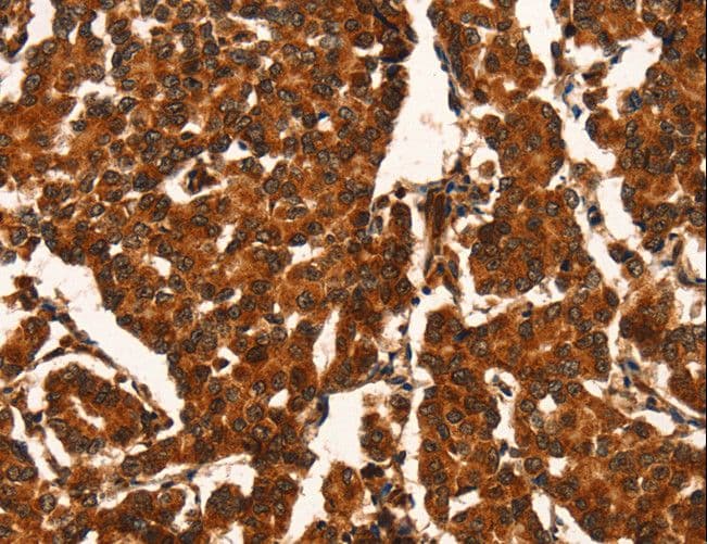 Polyclonal Rabbit anti-Human CUEDC2 Antibody (IHC, WB)
