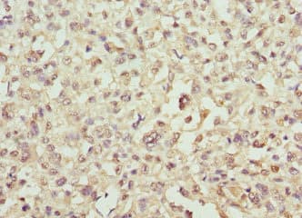 SNCA / Alpha-Synuclein Antibody