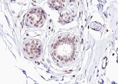 ER Alpha / Estrogen Receptor Antibody (phospho-Ser104)