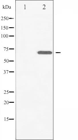 ZAP70 Antibody (phospho-Tyr493)