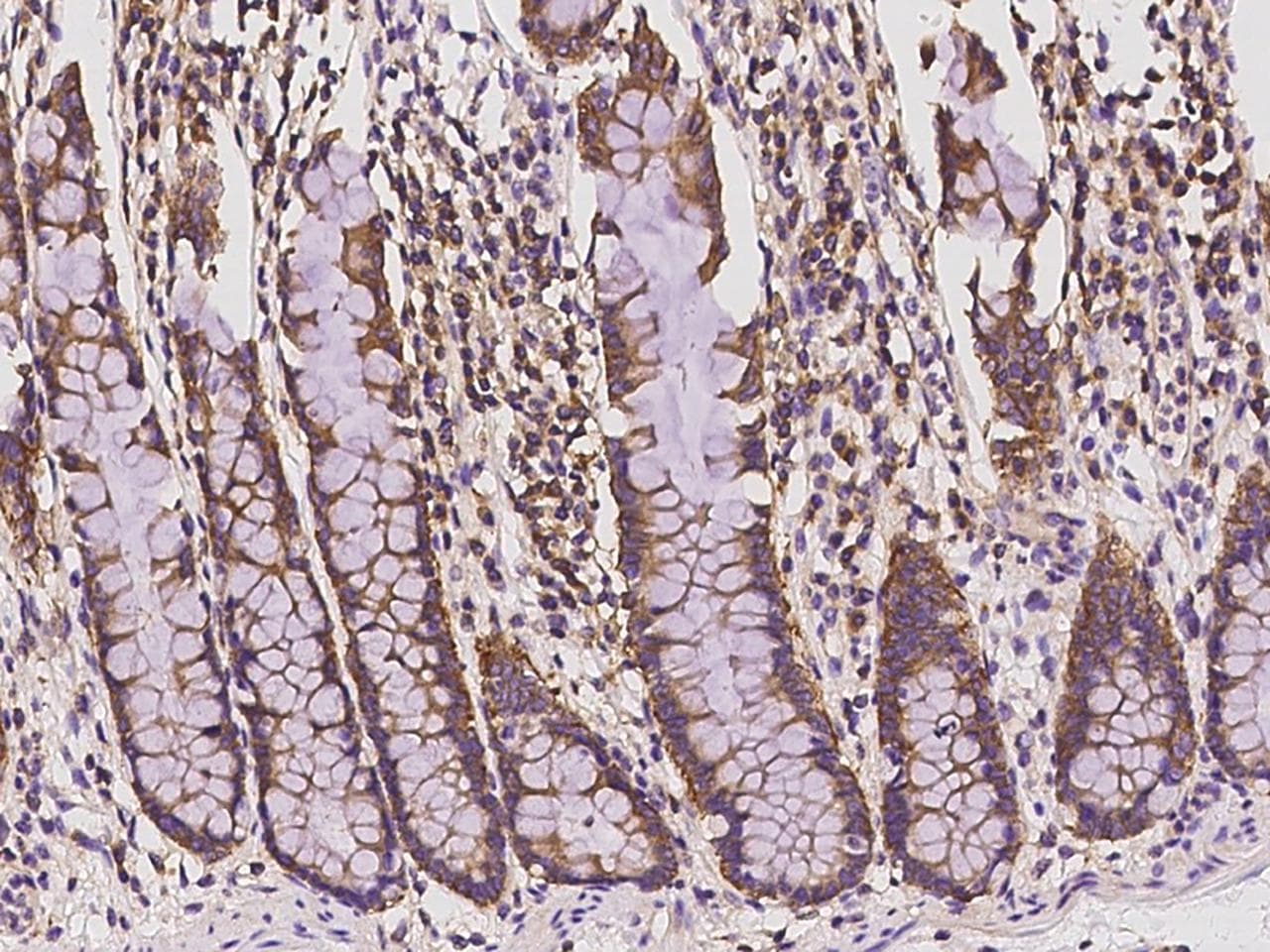SH3GLB2 / Endophilin-B2 Antibody