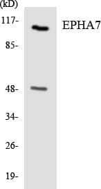 EPHA7 / EPH Receptor A7 Antibody (aa428-477)